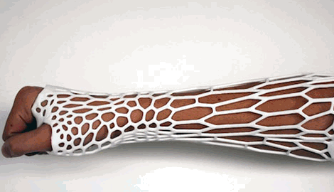 Cortex Cast impresoras 3D de exoesqueletos biomodelados